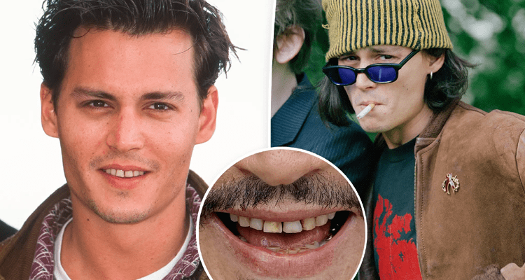 Latest News Johnny Depp Teeth Before And After